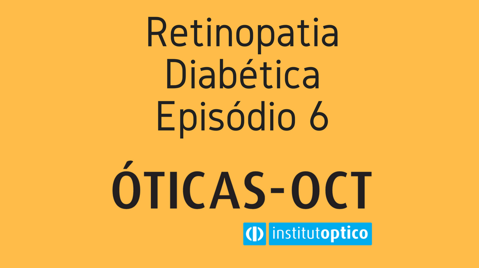 Espaço Óticas - OCT - Retinopatia diabética - Episódio 6