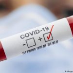 O concelho de Torres Vedras regista 47 casos ativos de doença COVID-19